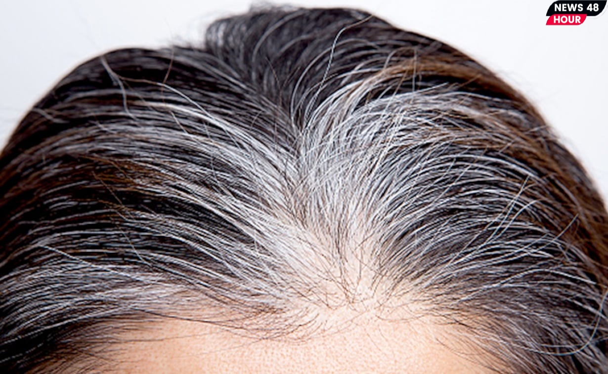 How to Prevent From White Hair ? इन घरेलू नुक्सो को अपना कर आप कर सकते है अपने सफ़ेद बालो को काला। 